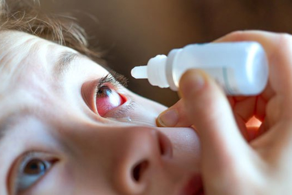 Desde 2016 se está presentando un brote de Conjuntivitis Hemorrágica Epidémica en países de la región de Las Américas, fundamentalmente en Haití y República Dominicana, por lo cual Cuba toma las medidas para evitar su propagación.