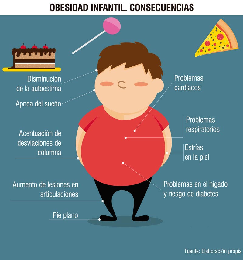 1025-OBESIDAD_NIÑOS_1.jpg