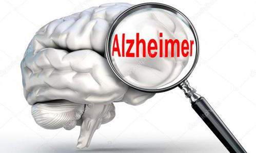 0921-Alzheimer-demencia.jpg