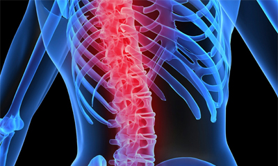 osteoporosis.jpg