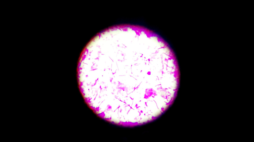 2006-vaginosis-citolitica0.jpg