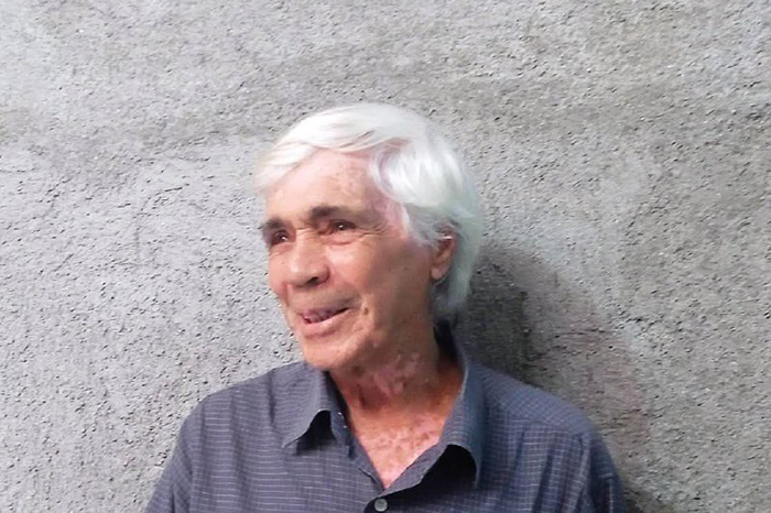 ACN - Cuba